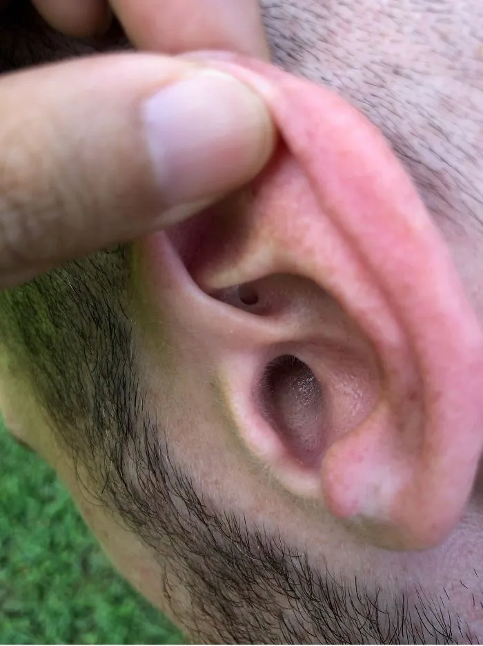 21. An Extra Hole in the Ear .jpg?format=webp