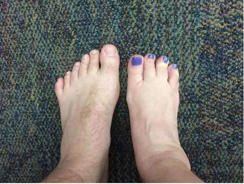 35. The Woman was Born with 6 Toes and Her Co-Worker Was Born With 4 Toes .jpg?format=webp