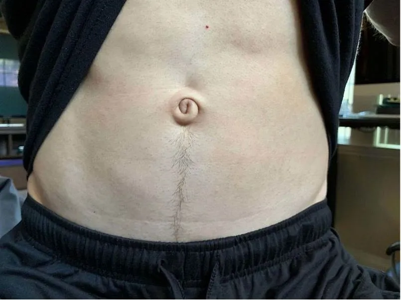 43. When a Belly Button Attracts a Lot of Comments.jpg?format=webp