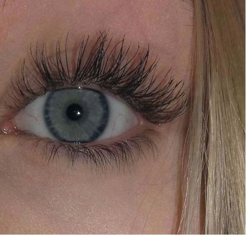48. Condition Caused Eyelashes to Grow in Multiple Rows.jpg?format=webp